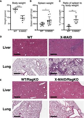 A Murine Model of X-Linked Moesin-Associated Immunodeficiency (X-MAID) Reveals Defects in T Cell Homeostasis and Migration